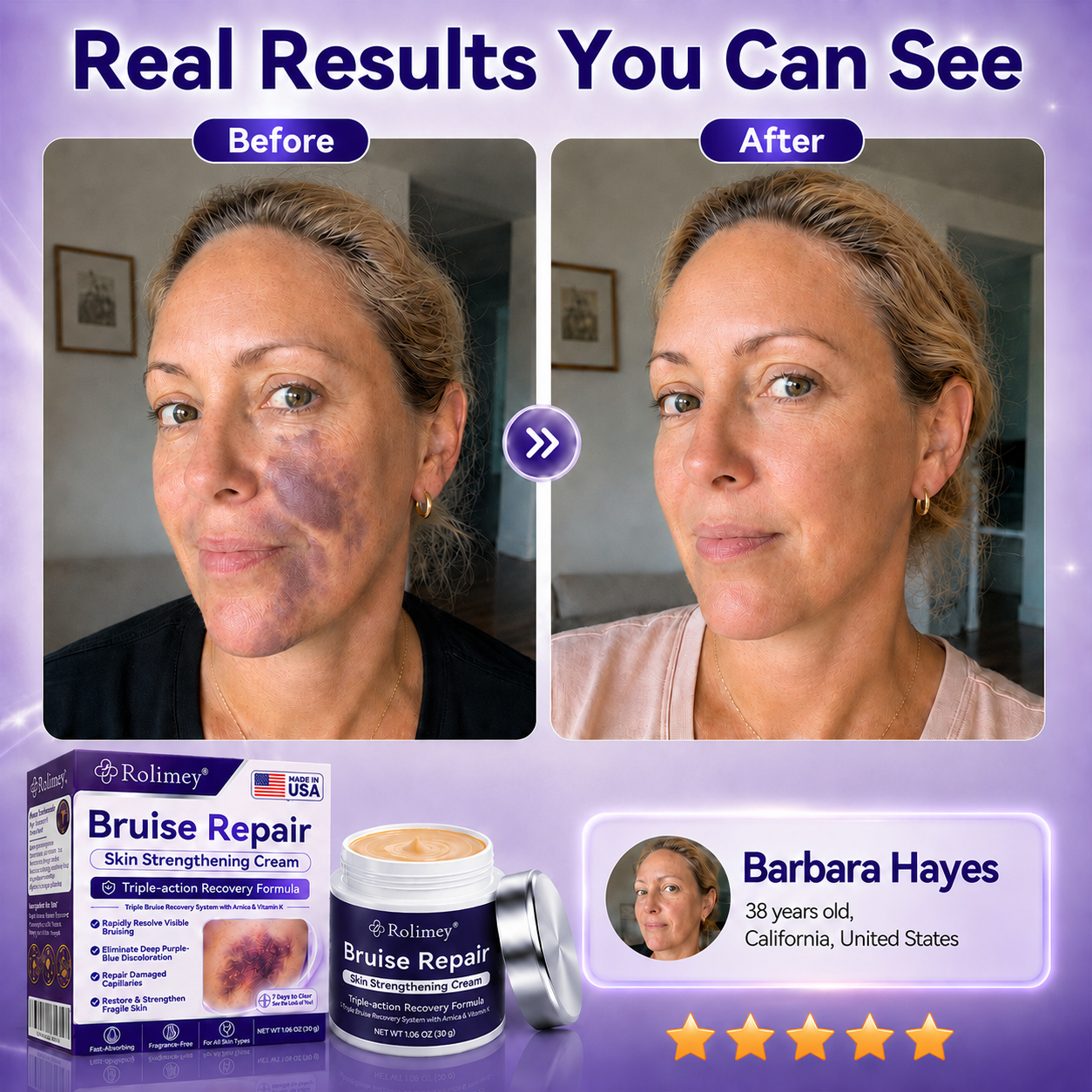 Rolimey® cream to repair bruises and strengthen the skin.