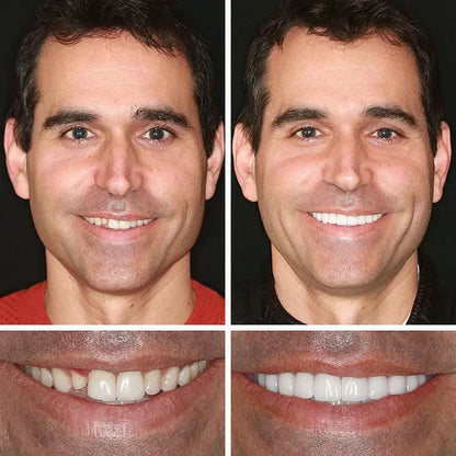 Offer ends today: 50% off! ⏰50% off! KLENIMORE™ Medical Grade, Strong Adhesion, Custom Fit