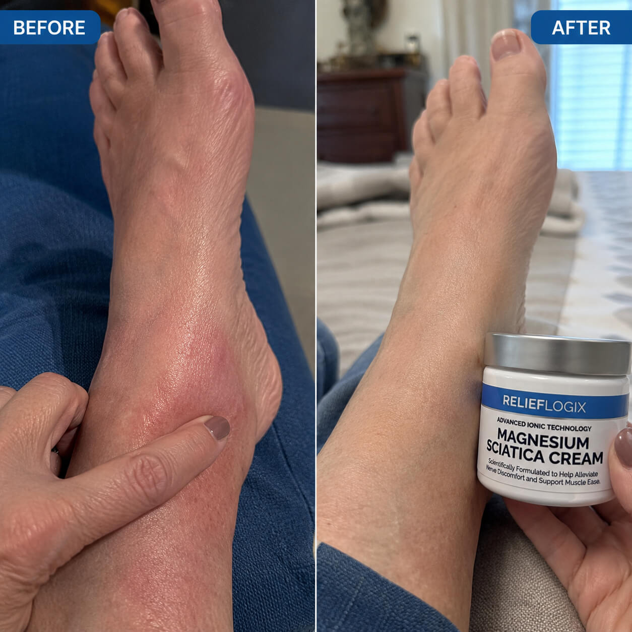 The Cream That Finally Reaches The Nerve