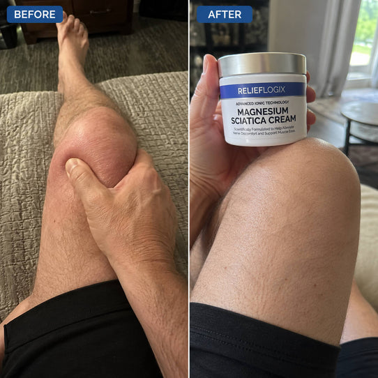The Cream That Finally Reaches The Nerve