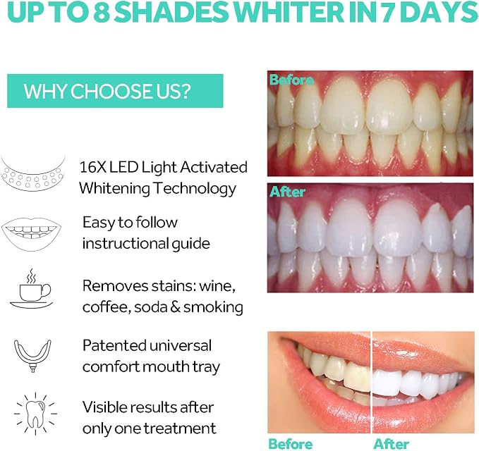 Instant Full Restoration Dentures – Fit At Home In Minutes