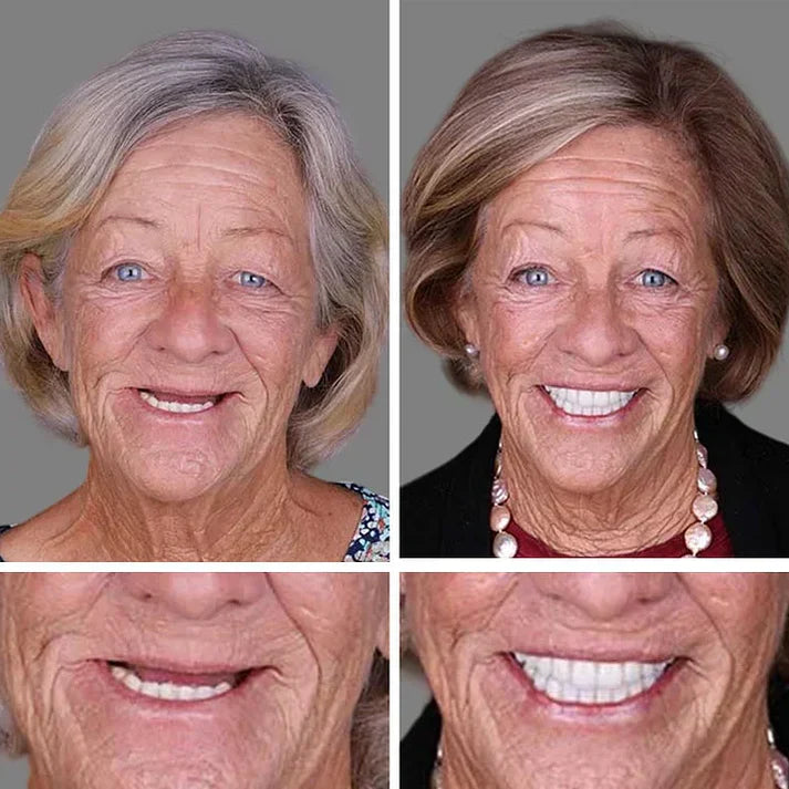 Offer ends today: 50% off! ⏰50% off! KLENIMORE™ Medical Grade, Strong Adhesion, Custom Fit