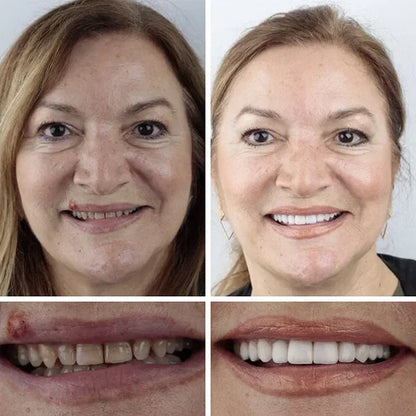 Offer ends today: 50% off! ⏰50% off! KLENIMORE™ Medical Grade, Strong Adhesion, Custom Fit