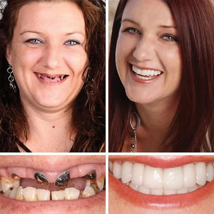 Offer ends today: 50% off! ⏰50% off! KLENIMORE™ Medical Grade, Strong Adhesion, Custom Fit