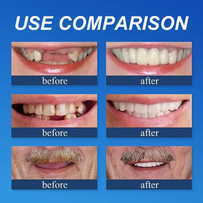 Offer ends today: 50% off! ⏰50% off! KLENIMORE™ Medical Grade, Strong Adhesion, Custom Fit